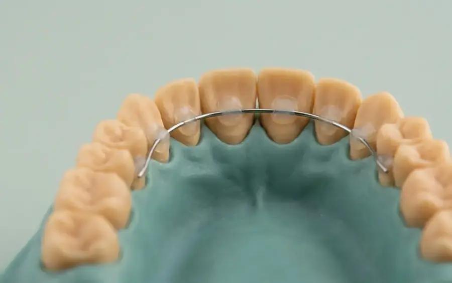 Retainer